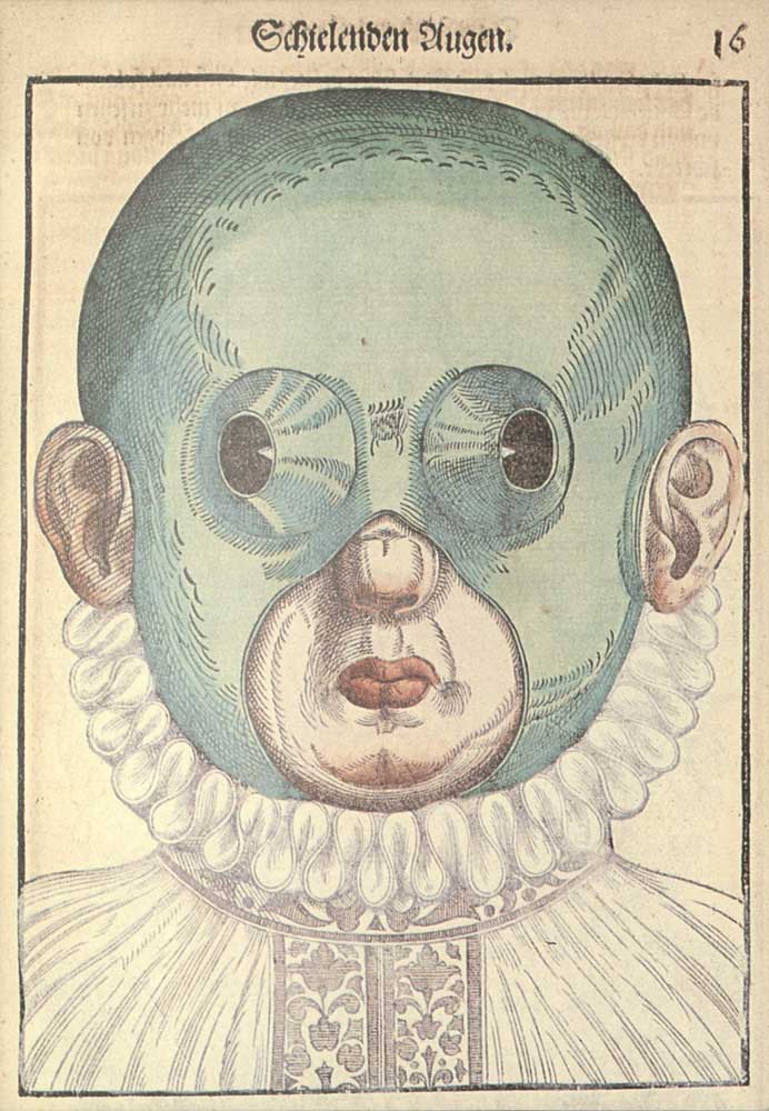 Vykort, Georg Bartisch (1535-1607) Ophthalmouduleia, das ist Augendienst. Handkolorerat träsnitt. Dresden, 1583.