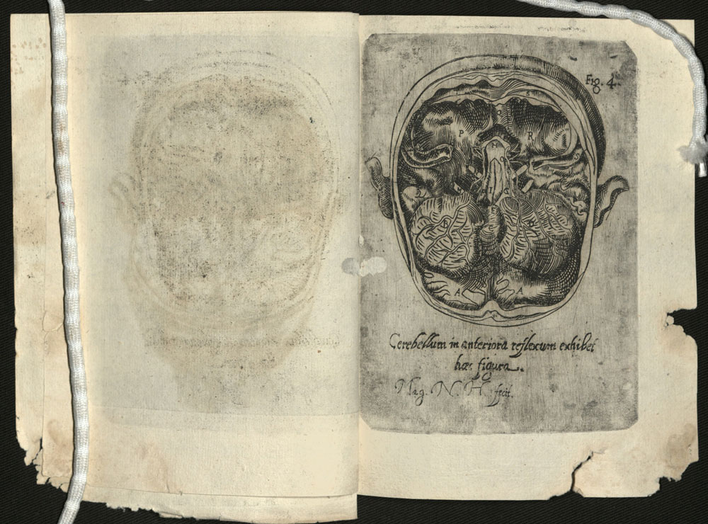 Engraving and etching by Magnus N. Celsius from De cerebro humano, 1645.