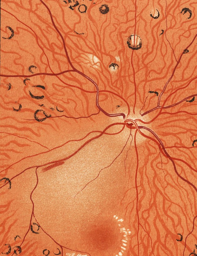 Fundus av Frost